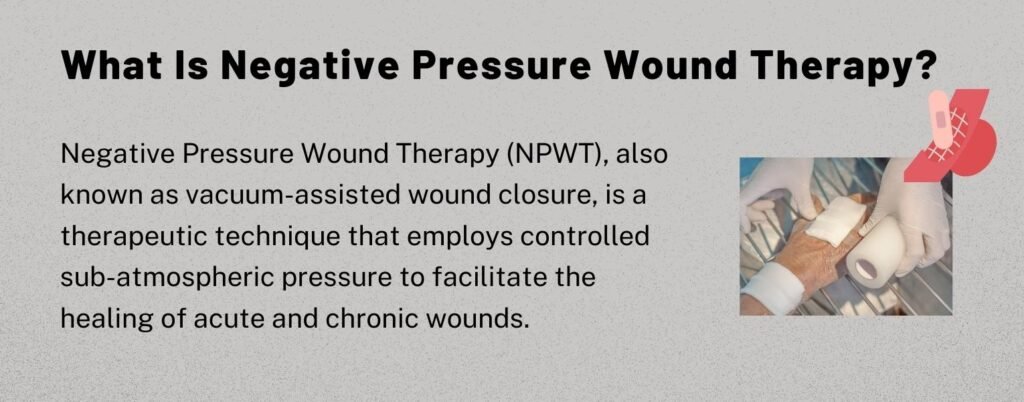 Small pump, complex requirements: the SP 270 EC in Negative Pressure Wound  Therapy (NPWT)